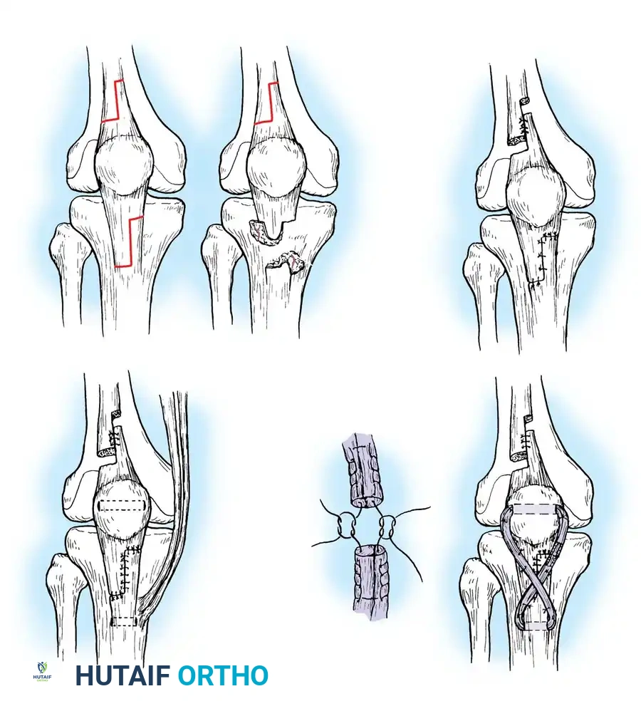 Hutaifortho's Orthopaedic Diagram