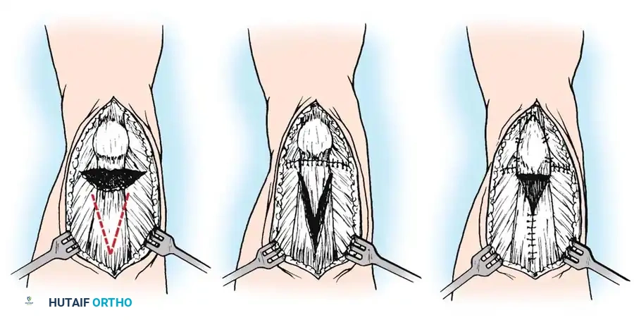 Hutaifortho's Orthopaedic Diagram
