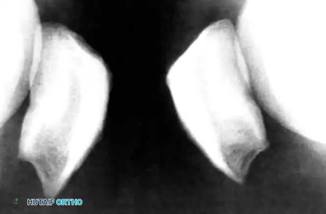 Hutaifortho's Orthopaedic Diagram