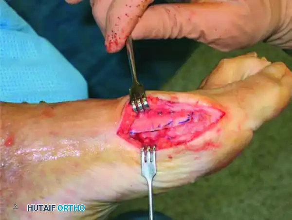 تخطيط الجراحة بناء على الأشعة