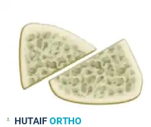 مرحلة التعافي الأولى بعد الجراحة