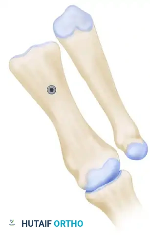 مقارنة قبل وبعد الجراحة