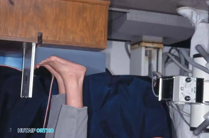 SESAMOID INJURIES OF THE HALLUX Surgical Diagram