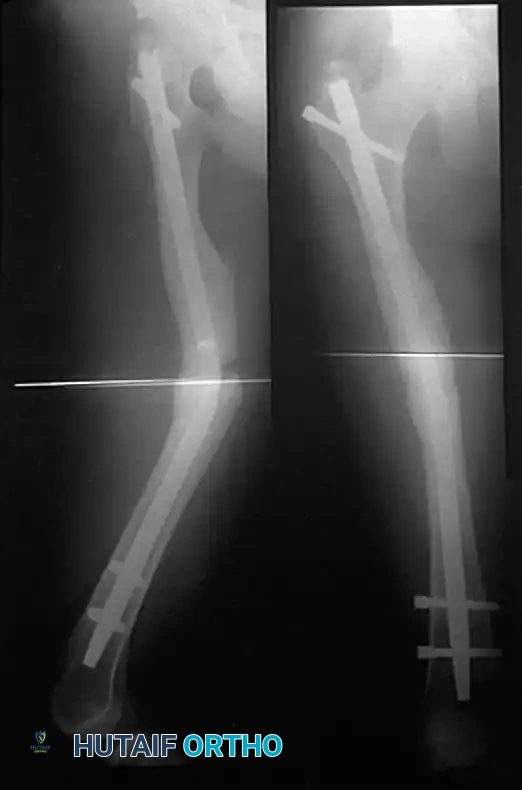 Hutaifortho's Orthopaedic Diagram