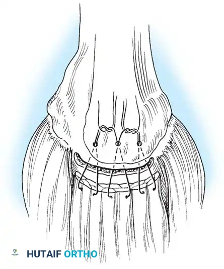 Hutaifortho's Orthopaedic Diagram