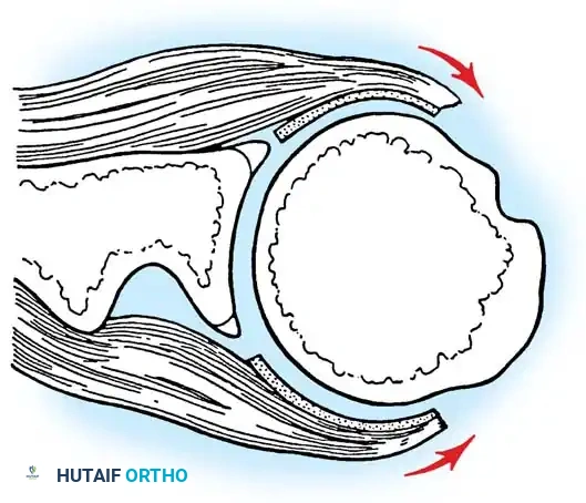 Hutaifortho's Orthopaedic Diagram