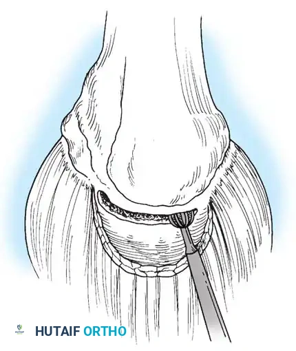 Hutaifortho's Orthopaedic Diagram