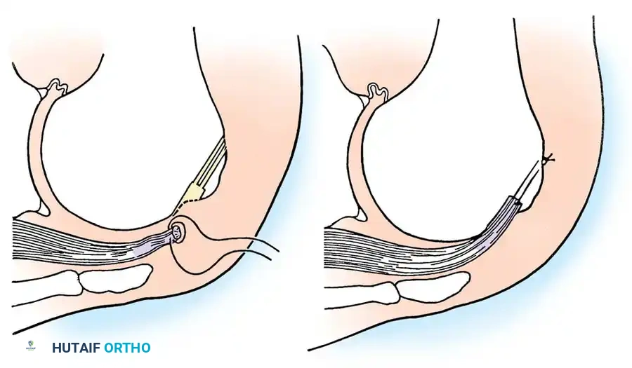 Hutaifortho's Orthopaedic Diagram