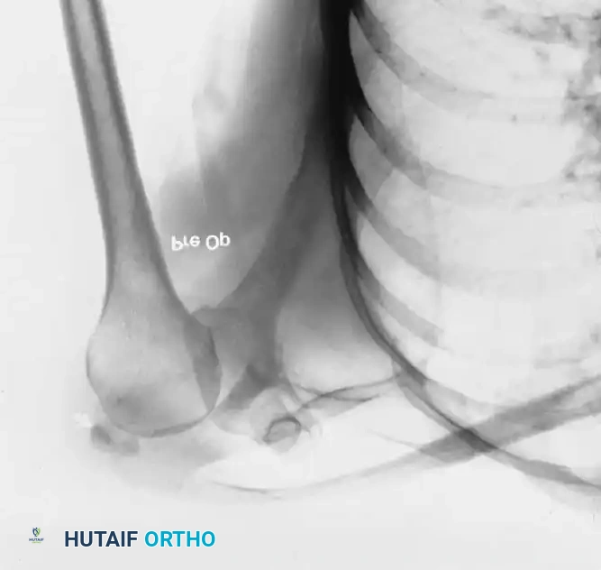 Hutaifortho's Orthopaedic Diagram