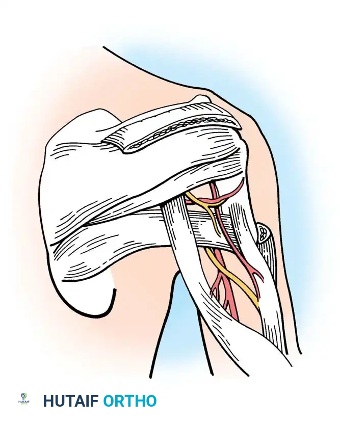Hutaifortho's Orthopaedic Diagram