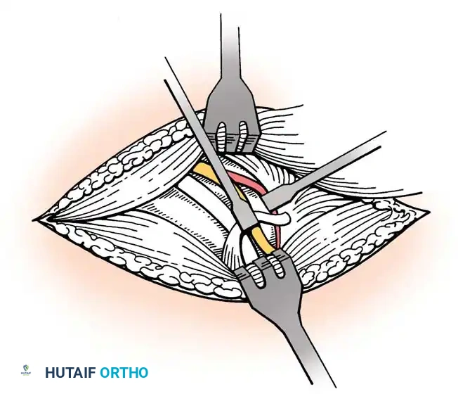 Hutaifortho's Orthopaedic Diagram