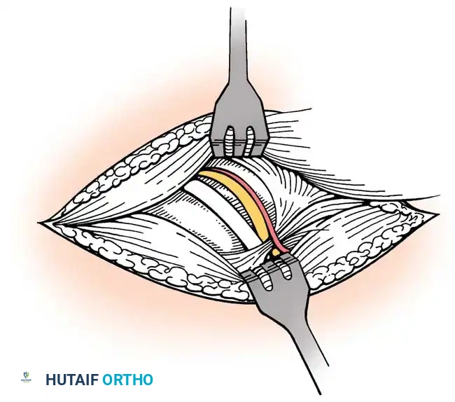 Hutaifortho's Orthopaedic Diagram