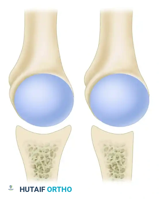 Masterclass in Shoulder Instability: Anatomy, Biomechanics, and Surgical Reconstruction