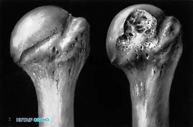 Hutaifortho's Orthopaedic Diagram