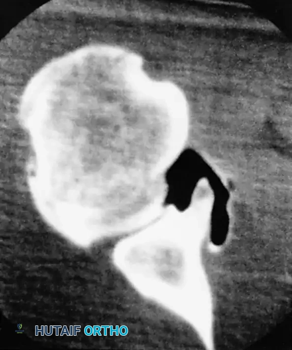 Hutaifortho's Orthopaedic Diagram