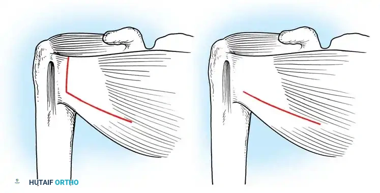 Hutaifortho's Orthopaedic Diagram