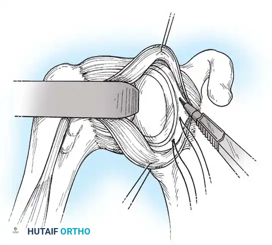 Hutaifortho's Orthopaedic Diagram