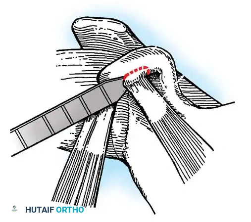 Hutaifortho's Orthopaedic Diagram