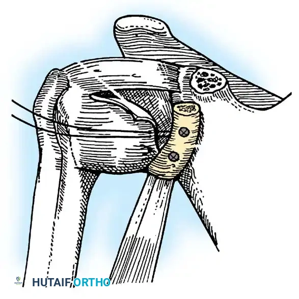 Hutaifortho's Orthopaedic Diagram