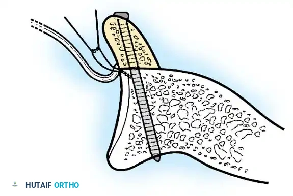 Hutaifortho's Orthopaedic Diagram