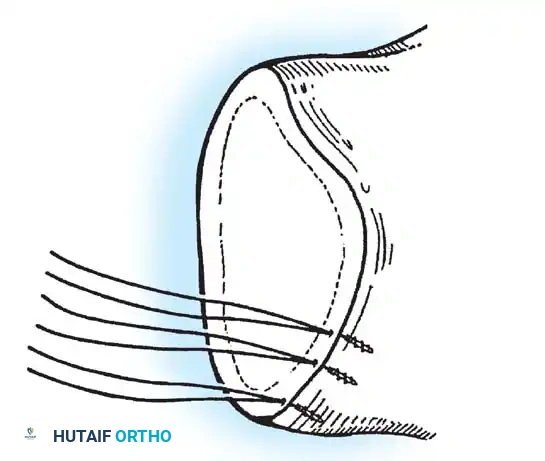 Hutaifortho's Orthopaedic Diagram