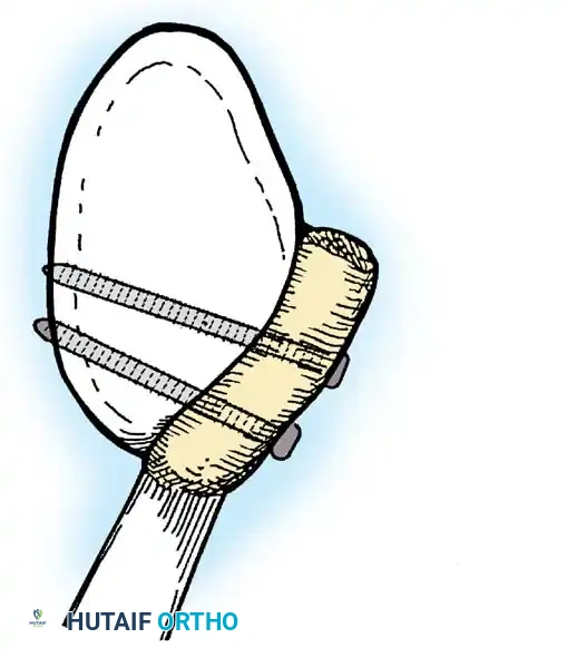 Hutaifortho's Orthopaedic Diagram