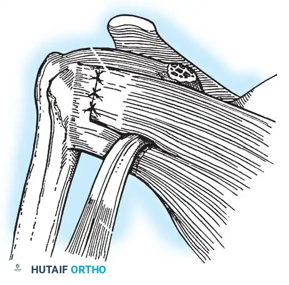 Hutaifortho's Orthopaedic Diagram