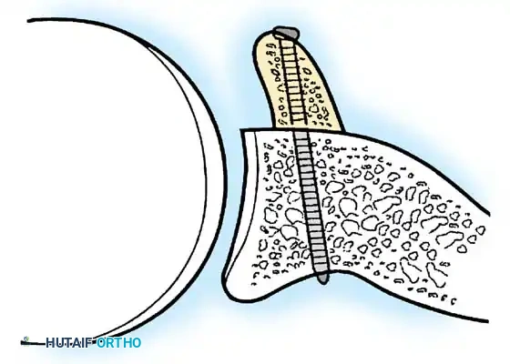 Hutaifortho's Orthopaedic Diagram