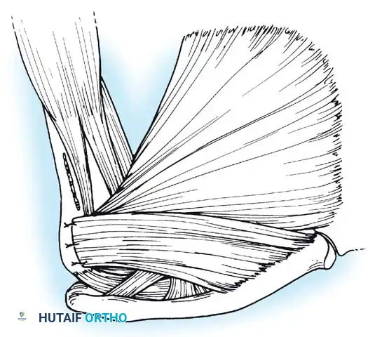 Hutaifortho's Orthopaedic Diagram