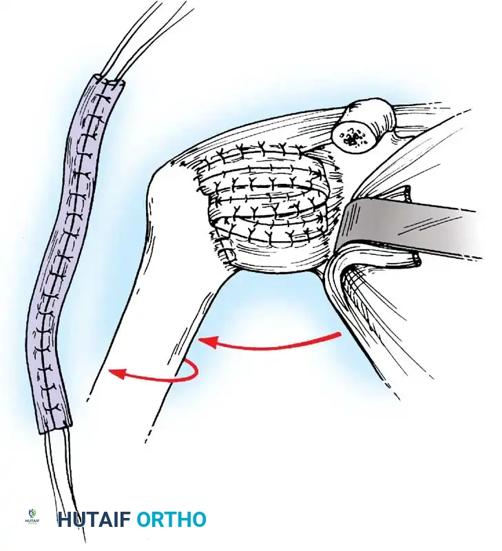 Hutaifortho's Orthopaedic Diagram