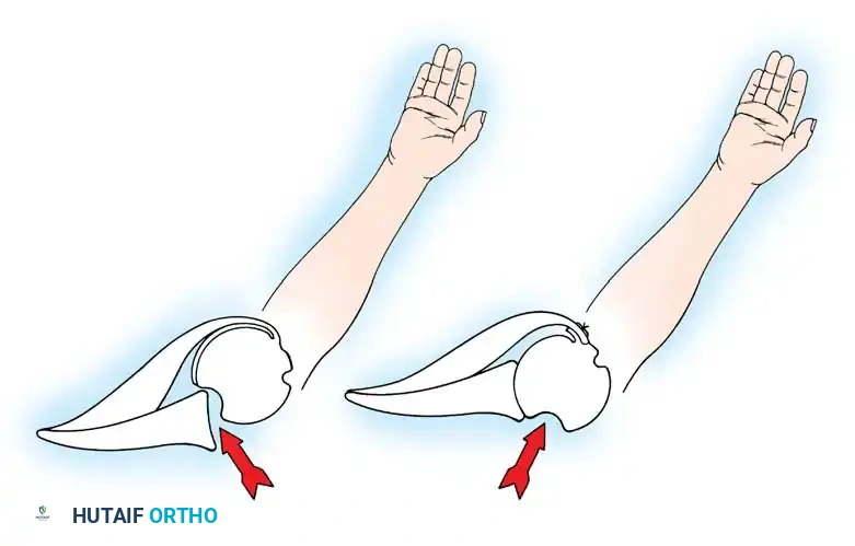 Hutaifortho's Orthopaedic Diagram