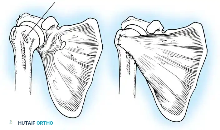 Hutaifortho's Orthopaedic Diagram