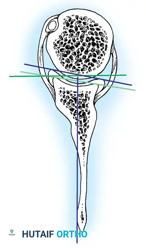 Hutaifortho's Orthopaedic Diagram