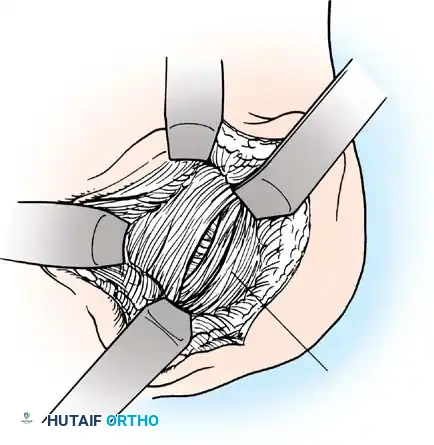 Hutaifortho's Orthopaedic Diagram