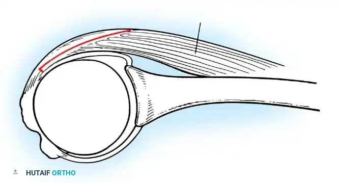 Hutaifortho's Orthopaedic Diagram