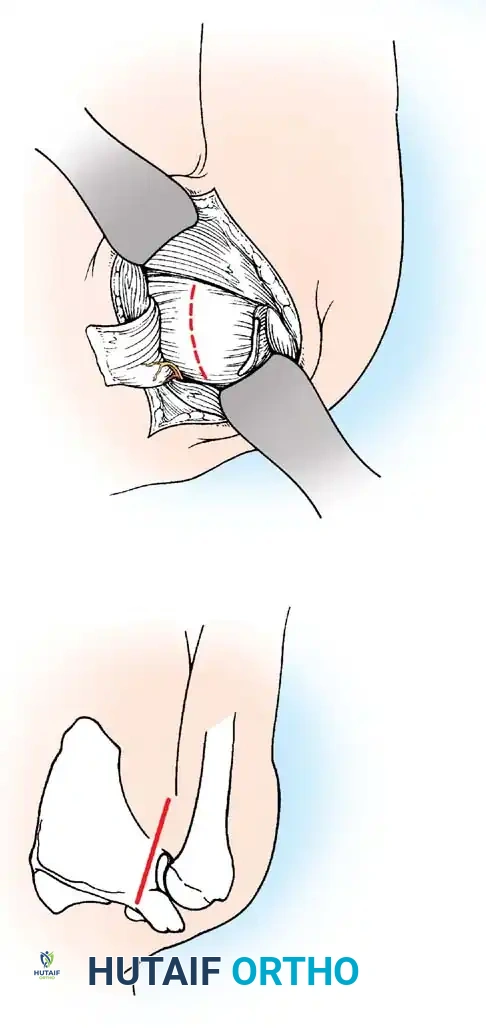 Hutaifortho's Orthopaedic Diagram