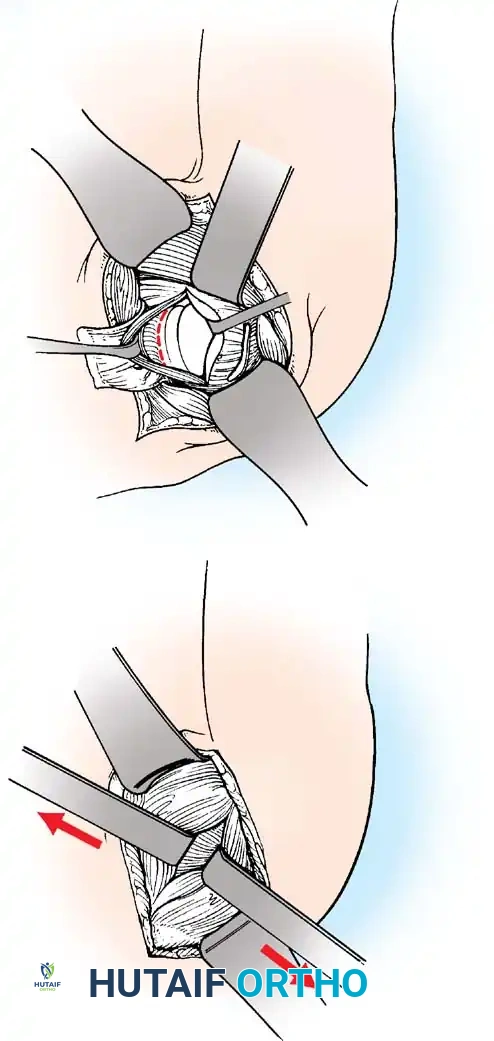 Hutaifortho's Orthopaedic Diagram