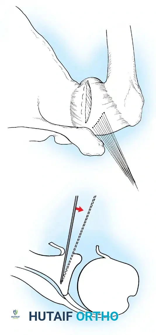 Hutaifortho's Orthopaedic Diagram