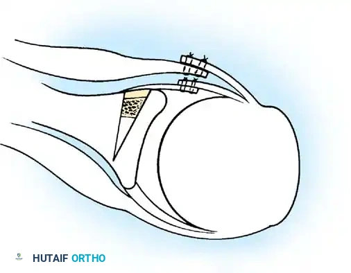 Hutaifortho's Orthopaedic Diagram