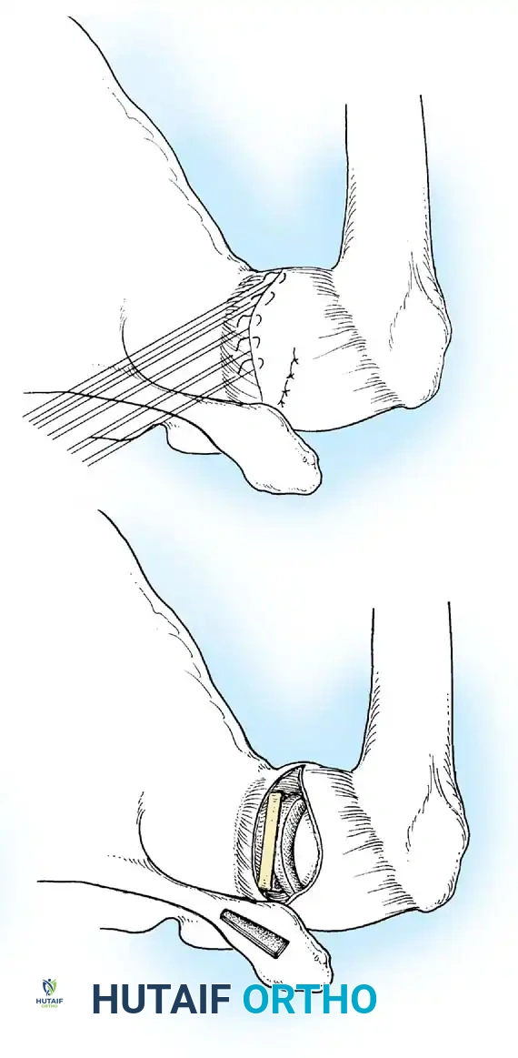 Hutaifortho's Orthopaedic Diagram