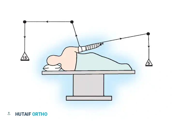 Fig. 49-2 Dual traction close up