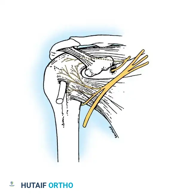 Hutaifortho's Orthopaedic Diagram