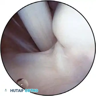 Hutaifortho's Orthopaedic Diagram