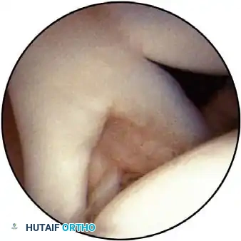 Hutaifortho's Orthopaedic Diagram