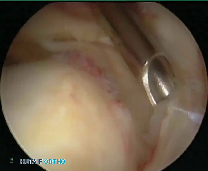 Hutaifortho's Orthopaedic Diagram