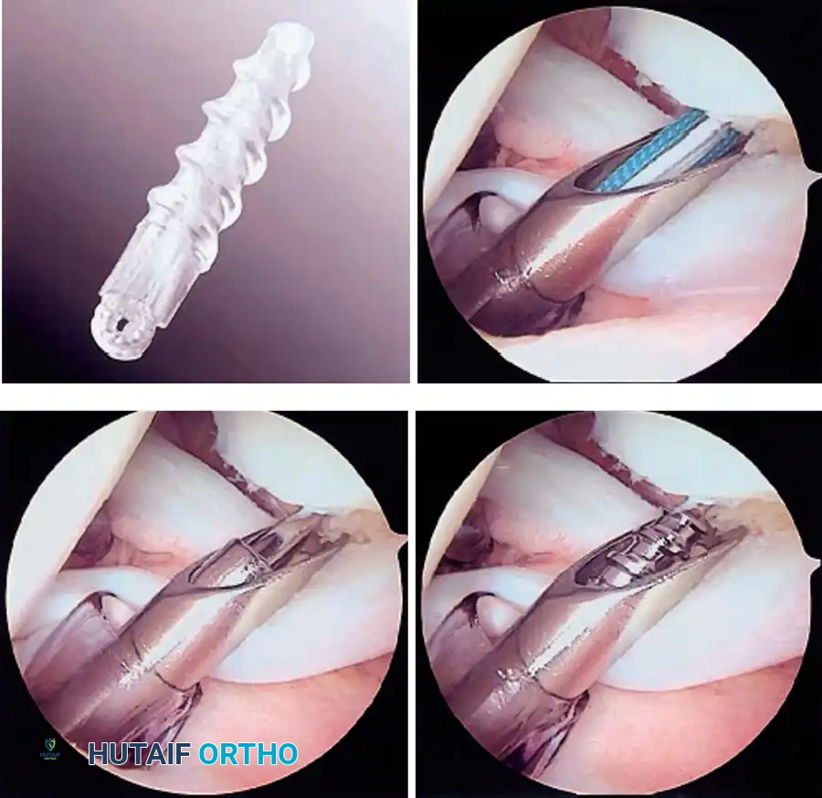 Hutaifortho's Orthopaedic Diagram
