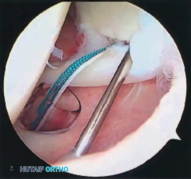 Hutaifortho's Orthopaedic Diagram