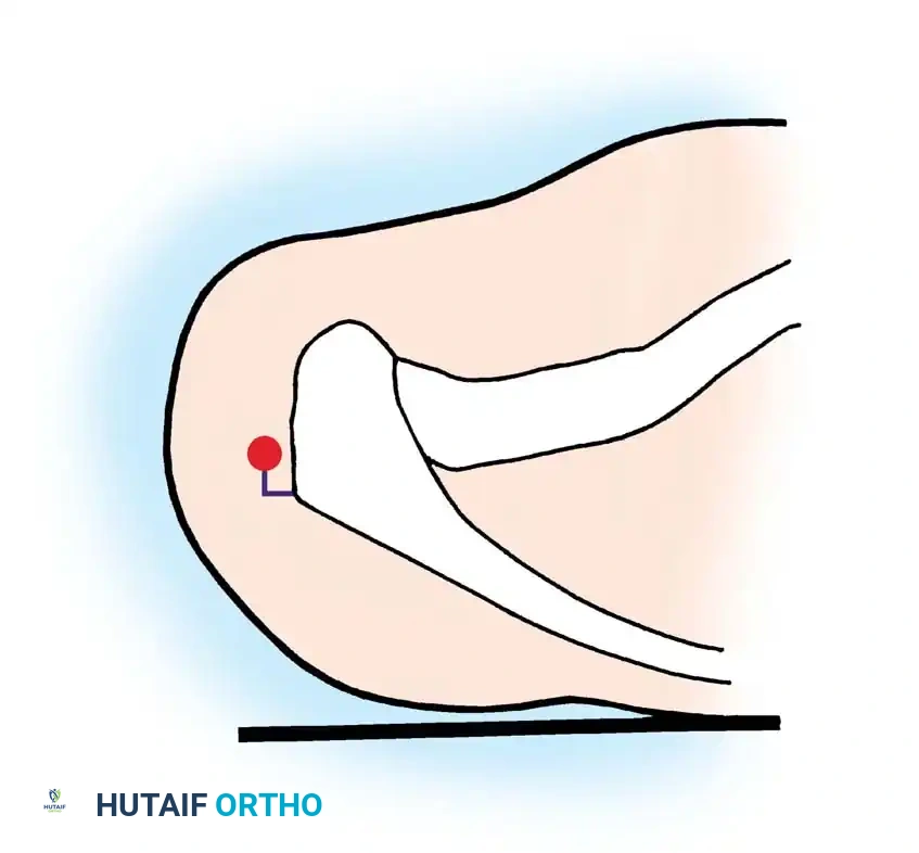Hutaifortho's Orthopaedic Diagram