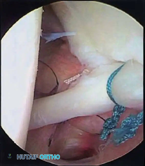 Hutaifortho's Orthopaedic Diagram
