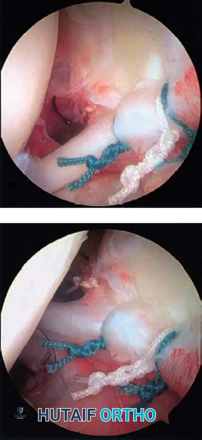 Hutaifortho's Orthopaedic Diagram